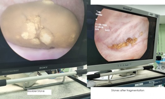 DR ONYANGO OLUOCH - UROLOGIST - KIDNEY STONES SPECIALIST IN NAIROBI