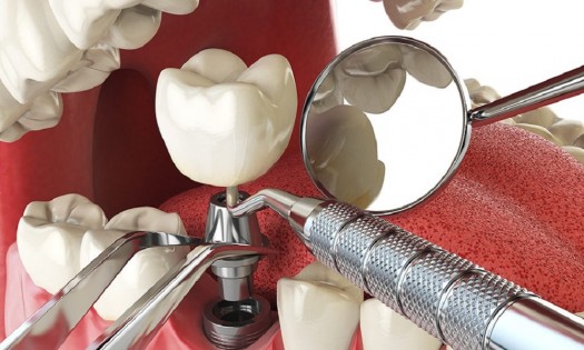 Balm Dental Care  - ORAL SURGERY SPECIALISTS IN NAIROBI